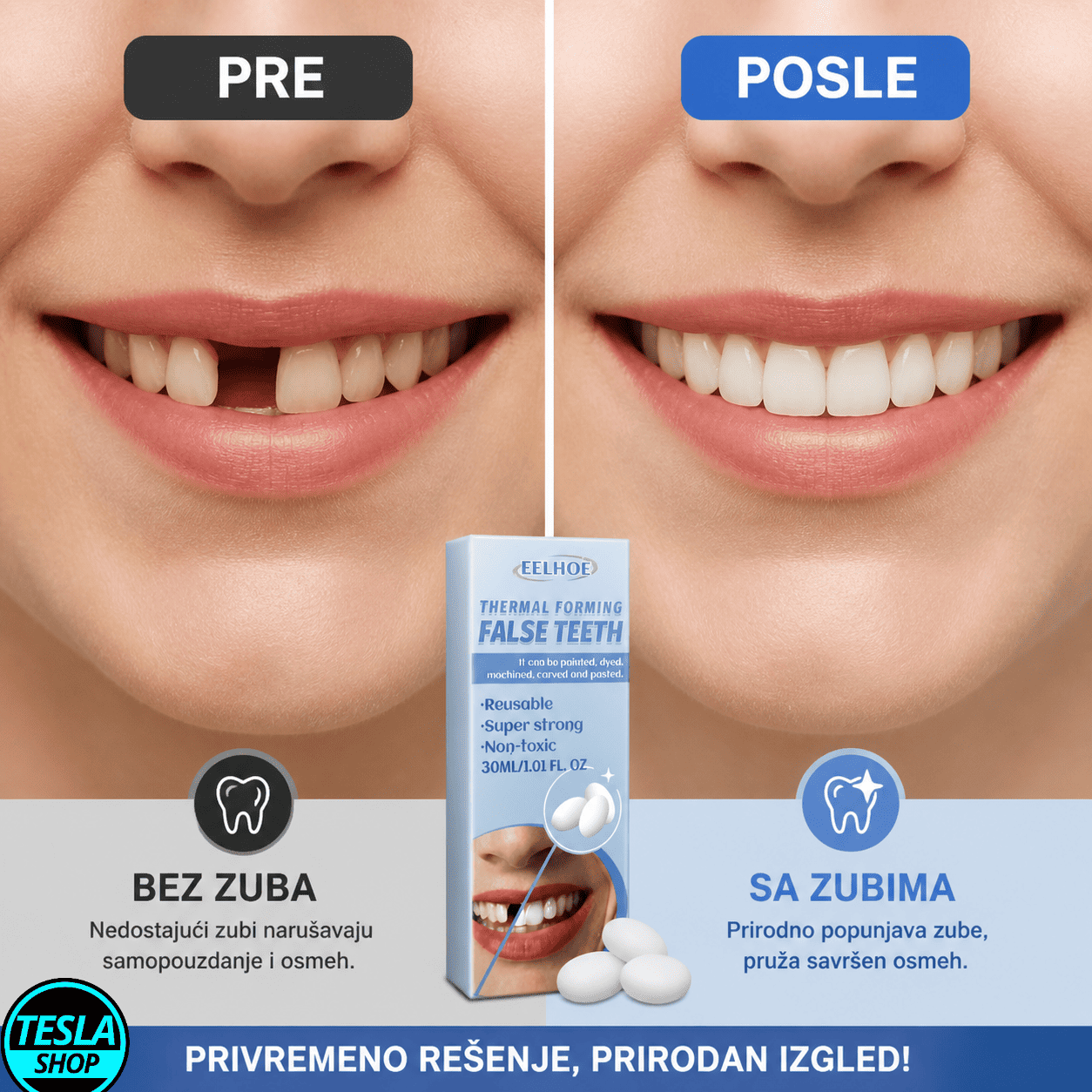 Privremeni zub – brzo rešenje za polomljen ili oštećen zub