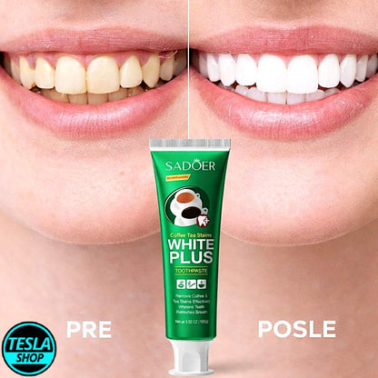 Pasta za zube za uklanjanje fleka od kafe, čaja i vina – izbeljivanje i zaštita zuba